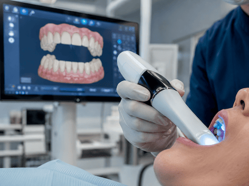 Tecnología de escaneo intraoral 3D en consulta